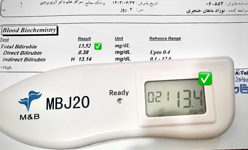 تست زردی نوزاد در منزل در تهران